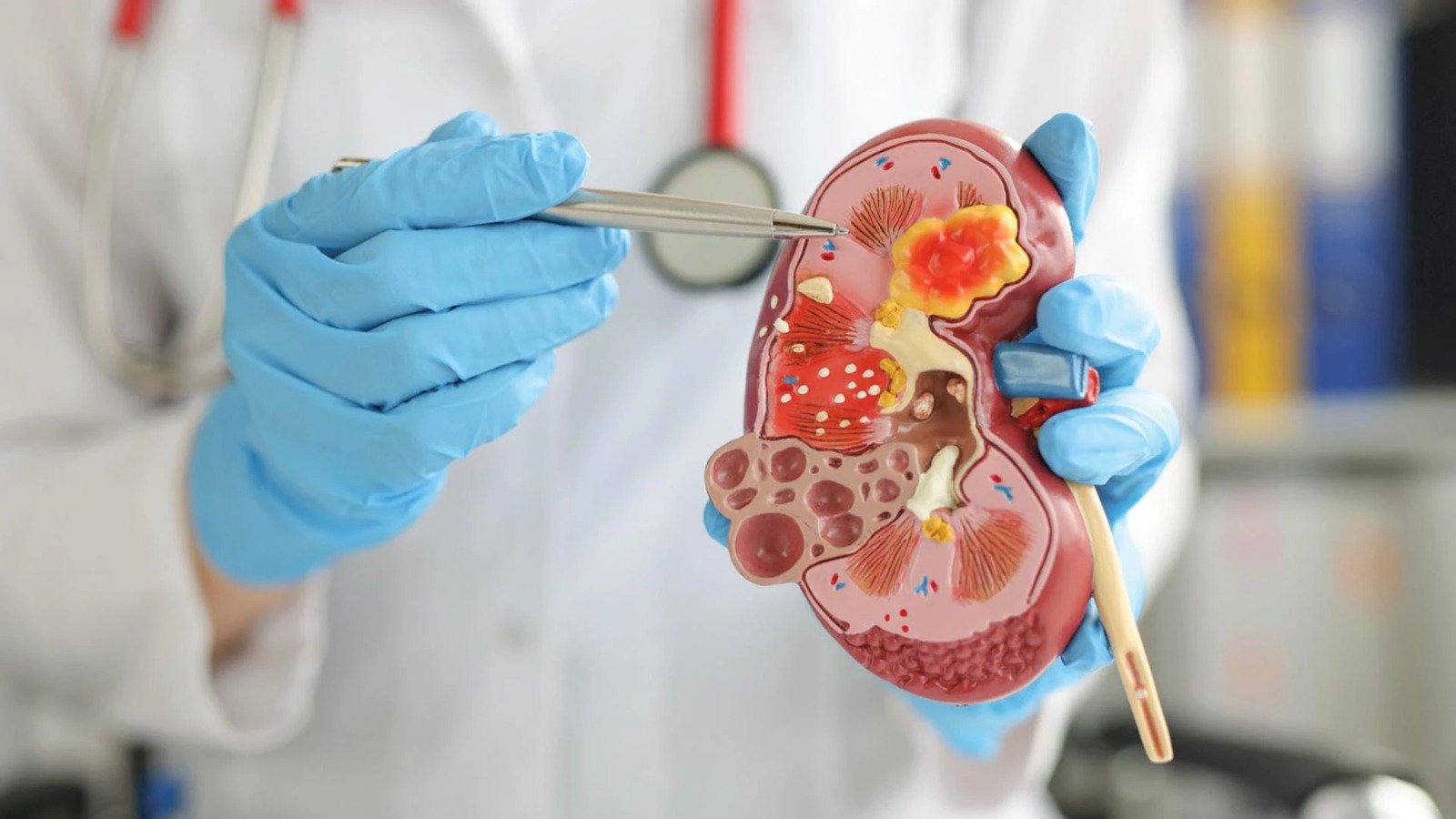 salud-renal